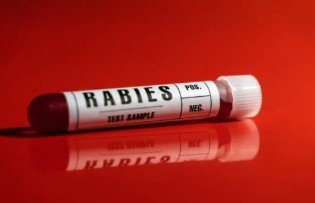 Rabies