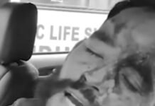 कुल्लू के रागी गांव में भूमि सीमांकन को लेकर बवाल, राजस्व अधिकारियों पर हमला, एक गंभीर रूप से घायल