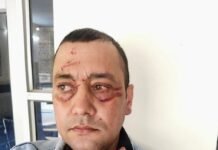 मंडी में साले ने पीट डाला जीजा, पहुंचाया अस्पताल, मामला दर्ज